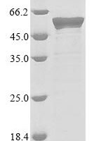 Human coronavirus HKU1 Nucleoprotein (N) Recombinant Protein, N-His - BioCrest Sci