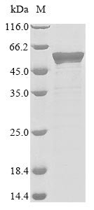 Human coronavirus HKU1 Nucleoprotein (N) Recombinant Protein, N-His, Human coronavirus HKU1 (isolate N5) (HCoV-HKU1), E.coli, N-terminal 6xHis-tagged, 53.2 kDa, purity >≥ 85% as determined by SDS-PAGE.