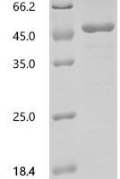 Dog Haptoglobin (HP) Recombinant Protein - BioCrest Sci
