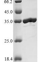 Escherichia coli Uncharacterized protein YncE (yncE) Recombinant Protein - BioCrest Sci