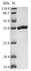 Escherichia coli Uncharacterized protein YncE (yncE) Recombinant Protein, Escherichia coli (strain K12), E.coli, C-terminal 6xHis-tagged, 36.3 kDa, purity >≥ 90% as determined by SDS-PAGE.