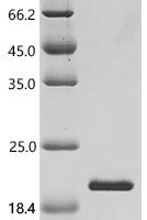 Macaca fascicularis Interleukin (IL21) Recombinant Protein - BioCrest Sci