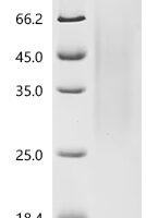 Human Zinc finger CCCH domain-containing protein 14 (ZC3H14) Recombinant Protein - BioCrest Sci