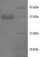 Human Cytochrome b-c1 complex subunit 8 (UQCRQ), partial Recombinant Protein - BioCrest Sci