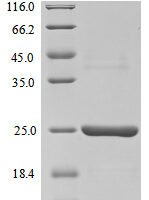 Mouse Caspase-12 (Casp12), partial Recombinant Protein - BioCrest Sci