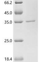 Tachypleus tridentatus clotting factor C, partial Recombinant Protein, N-His, aa 763–1019, E.coli - BioCrest Sci