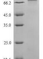 Arabidopsis thaliana Catalase-2 (CAT2) Recombinant Protein - BioCrest Sci