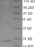 Human Neurofascin (NFASC), partial Recombinant Protein - BioCrest Sci