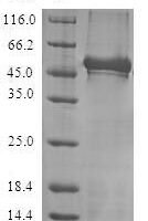 Human Neuronal calcium sensor 1 (NCS1) Recombinant Protein - BioCrest Sci