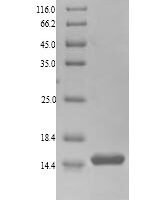Bertholletia excelsa 2S sulfur-rich seed storage protein 1 (BE2S1), partial Recombinant Protein - BioCrest Sci