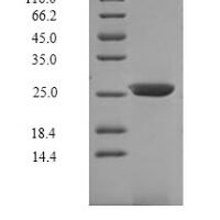 Mouse Interleukin-7 receptor subunit alpha (Il7r), partial Recombinant Protein, C-9xHis - BioCrest Sci
