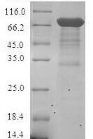 Human Steroid hormone receptor ERR1 (ESRRA) Recombinant Protein, N-GST - BioCrest Sci