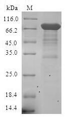 Human Steroid hormone receptor ERR1 (ESRRA) Recombinant Protein, N-GST, Homo sapiens (Human), E.coli, N-terminal GST-tagged, 72.5 kDa, purity >≥ 90% as determined by SDS-PAGE.