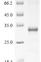 Human papillomavirus type 18 Probable protein E5 (E5) Recombinant Protein - BioCrest Sci