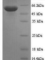 Mouse Spermine oxidase (Smox) Recombinant Protein, N-His - BioCrest Sci