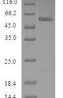 Human Nicotinamide N-methyltransferase (NNMT) Recombinant Protein - BioCrest Sci