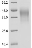 Human Interleukin-18-binding protein (IL18BP) Recombinant Protein, C-10His - BioCrest Sci