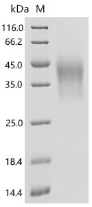Human Interleukin-18-binding protein (IL18BP) Recombinant Protein, C-10His, Mammalian cell, C-terminal 10xHis-tagged, 19.3 kDa, purity >≥ 95% as determined by SDS-PAGE.
