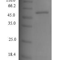 Human Tyrosinase (TYR), partial Recombinant Protein, N-His - BioCrest Sci