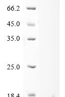Dendroaspis polylepis polylepis Kunitz-type serine protease inhibitor dendrotoxin E Recombinant Protein - BioCrest Sci