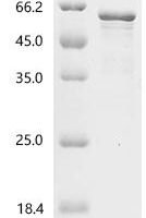 Human Hepatocyte nuclear factor 3-alpha (FOXA1) Recombinant Protein, C-His - BioCrest Sci