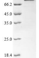Moloney murine leukemia virus Gag-Pol polyprotein (gag-pol), partial Recombinant Protein - BioCrest Sci