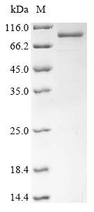 Moloney murine leukemia virus Gag-Pol polyprotein (gag-pol), partial Recombinant Protein, Moloney murine leukemia virus (isolate Shinnick) (MoMLV), E.coli, N-terminal 10xHis-tagged and C-terminal Myc-tagged, 82.1 kDa, purity >≥ 85% as determined by SDS-PAGE.