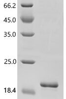 Mouse Integrin beta-1 (Itgb1), partial Recombinant Protein, N-His, aa 752–798, E.coli - BioCrest Sci