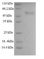 Infectious bronchitis virus Spike glycoprotein S1 subunit (S1), partial Recombinant Protein, N-GST - BioCrest Sci