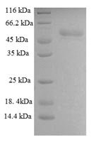 Infectious bronchitis virus Spike glycoprotein S1 subunit (S1), partial Recombinant Protein, N-GST, Infectious bronchitis virus, E.coli, N-terminal GST-tagged, 61.7 kDa, purity >≥ 90% as determined by SDS-PAGE.