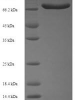 Human Acyl-CoA-binding domain-containing protein 5 (ACBD5), partial Recombinant Protein - BioCrest Sci