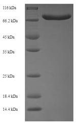 Human Acyl-CoA-binding domain-containing protein 5 (ACBD5), partial Recombinant Protein, Homo sapiens (Human), E.coli, N-terminal 6xHis-SUMO-tagged, 67.5 kDa, purity >≥ 90% as determined by SDS-PAGE.