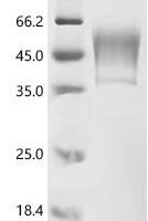 Human Protein PBMUCL2 (HCG22) Recombinant Protein - BioCrest Sci