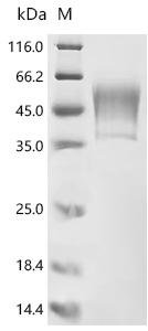 Human Protein PBMUCL2 (HCG22) Recombinant Protein, Homo sapiens (Human), Mammalian cell, C-terminal 10xHis-tagged, 25.2 kDa, purity >≥ 95% as determined by SDS-PAGE.