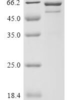 Streptococcus pyogenes serotype M1 C5a peptidase (scpA), partial Recombinant Protein - BioCrest Sci