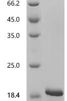Mouse VIP peptides (Vip) Recombinant Protein, C-His, aa 80–155, E.coli - BioCrest Sci