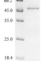 Human Acetyl-CoA acetyltransferase,mitochondrial (ACAT1) Recombinant Protein - BioCrest Sci