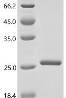 Human Hemoglobinsubunit beta(HBB) Recombinant Protein - BioCrest Sci
