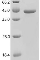 Human Thioredoxin, mitochondrial (TXN2) Recombinant Protein - BioCrest Sci