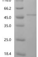 Human Paraneoplastic antigen Ma1 (PNMA1) Recombinant Protein, C-His - BioCrest Sci