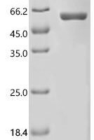 Rat Acyl-coenzyme A thioesterase 1 (Acot1) Recombinant Protein, C-His - BioCrest Sci