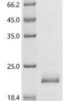 Naja atra Acidic phospholipase A2 2 Recombinant Protein - BioCrest Sci