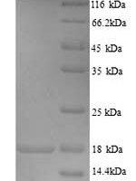 Human Store-opeRated calcium entry-associated regulatory factor (SARAF), partial Recombinant Protein - BioCrest Sci