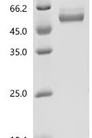Human T-cell immunoreceptor with Ig and ITIM domains(TIGIT), partial, Biotinylated Recombinant Protein - BioCrest Sci