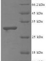 Bacillus cereus Methylglyoxal synthase (mgsA) Recombinant Protein - BioCrest Sci