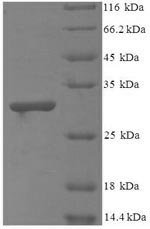 Bacillus cereus Methylglyoxal synthase (mgsA) Recombinant Protein, Bacillus cereus (strain 03BB102), E.coli, N-terminal 6xHis-SUMO-tagged, 30.7 kDa, purity >≥ 90% as determined by SDS-PAGE.