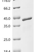 Human Von Hippel-Lindau disease tumor suppressor (VHL) Recombinant Protein - BioCrest Sci