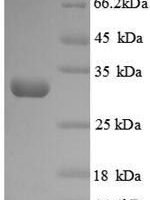 Human Protein-lysine 6-oxidase (LOX), partial Recombinant Protein, N-His - BioCrest Sci