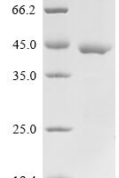 Mouse Protein bicaudal D homolog 2 (Bicd2), partial Recombinant Protein - BioCrest Sci