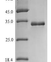 Human Protein S100-A14 (S100A14) Recombinant Protein, N-His-SUMOstar - BioCrest Sci